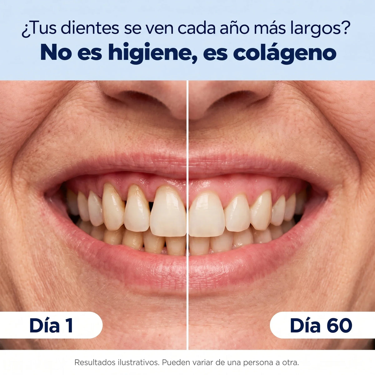 Dentiva - Terapia de Luz Roja